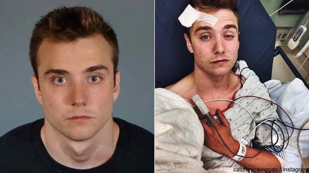 Idiot YouTuber Charged With Felony After Faking Gay Hate Crime