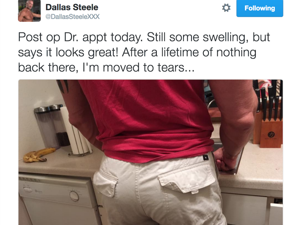 Gay Porn Star Dallas Steele “Moved To Tears” After Getting Ass Implants