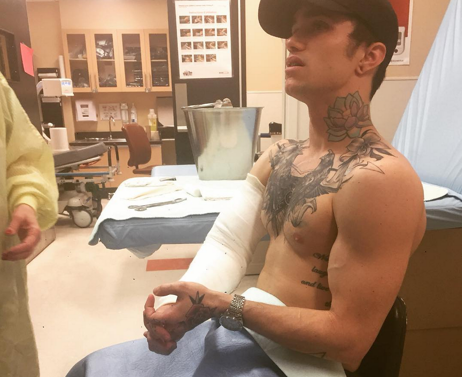 Even With A Broken Arm After A Skiing Accident, He Still Looks So Hot