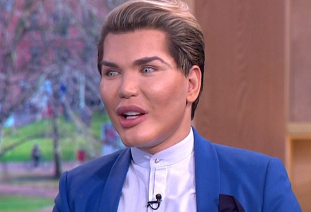 Multiple Plastic Surgeries Have Caused Breathing Problems For Human Ken Doll