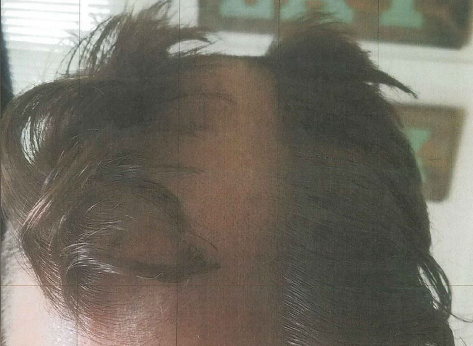 Wisconsin Hair Stylist Arrested After Cutting Customer’s Ear During Haircut