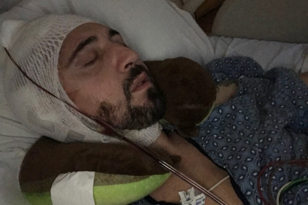 Gay Porn Star Jimmy Durano Recovering From Accident And Brain Surgery