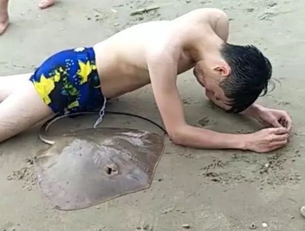 Tourist Crawls To Chinese Beach After Being Stung By Stingray—With Stingray Still Attached To Penis!