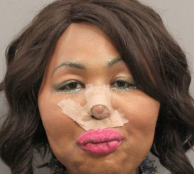 Drag Queen Bank Robber Arrested After Cosmetic Procedure In Mexico