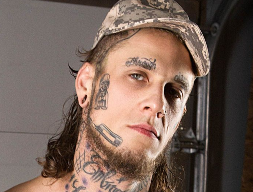 Costly Face Tattoo Removals On The Rise As Regret Sets In