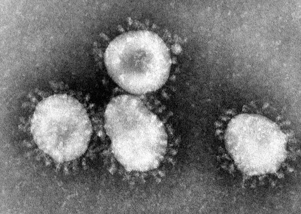 Illinois Wife Gives Husband Coronavirus In First U.S. Case Of Human-To-Human Transmission