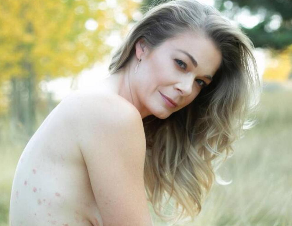 “How Do I Live” Singer LeAnn Rimes Poses Nude To Bring Attention To Psoriasis