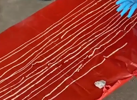 Doctors Remove 59-Foot Tape Worm From Anus Of Man Complaining Of Flatulence