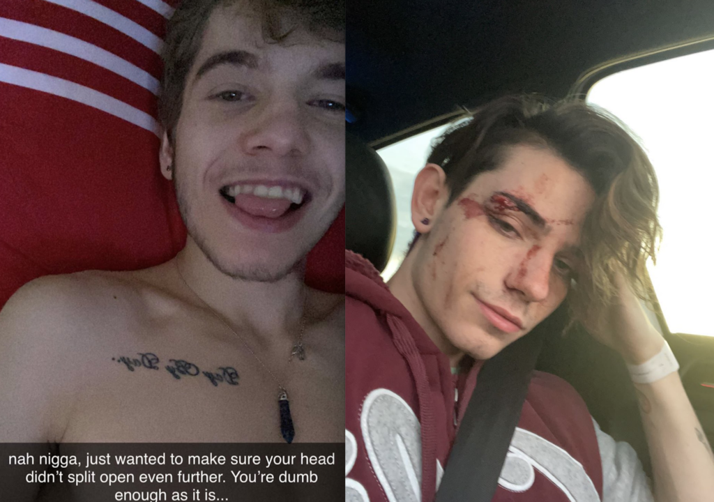 Former Helix Models Levi Rhodes And Eli  Bennet Clash Over Incident That Left Bennet With Bloodied Face, While Rhodes Defends Use Of N-Word By Claiming To Be Black