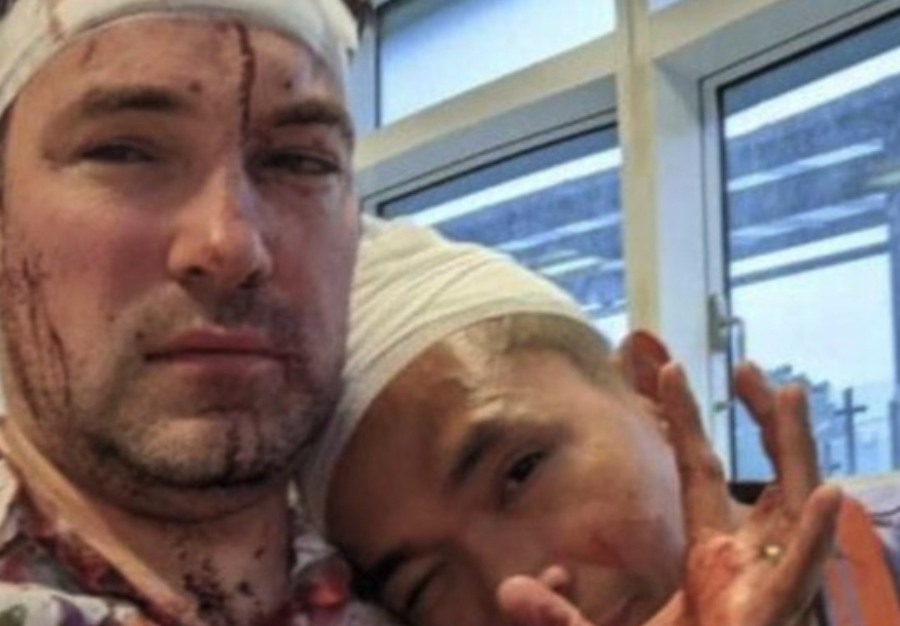 UK Gay Couple Left Bloodied After Homophobic Attack In Birmingham