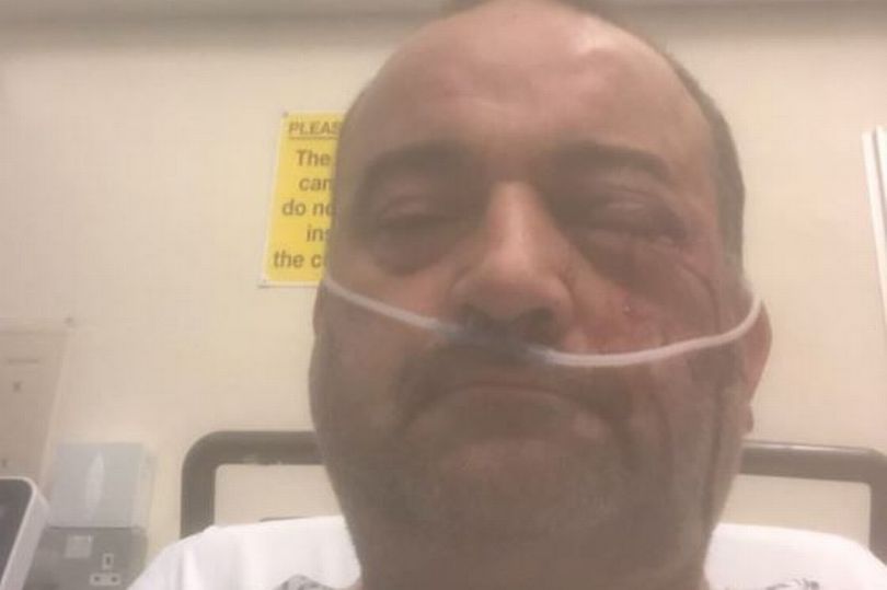 Man Could Lose Sight After Being Beaten Unconscious In Another Violent Anti-Gay Attack In Birmingham
