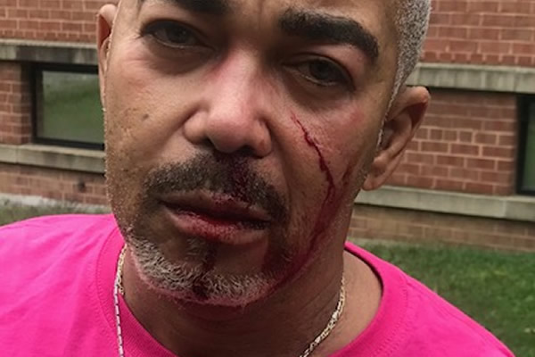 Gay Man Beaten By Washington D.C. Family Who Yelled Homophobic Slurs