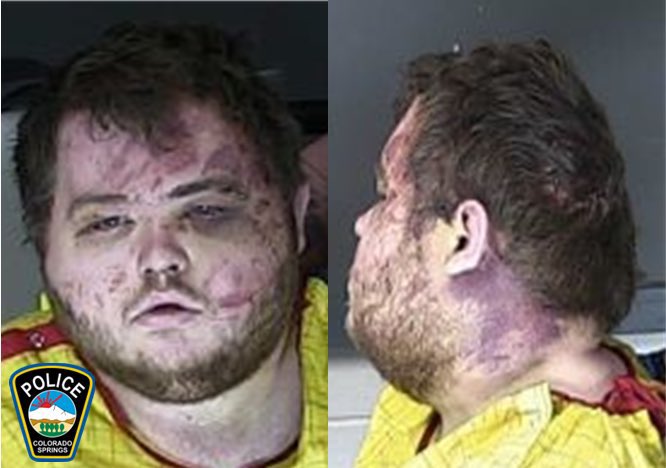 Mug Shot And First Court Appearance From Colorado Gay Nightclub Shooter