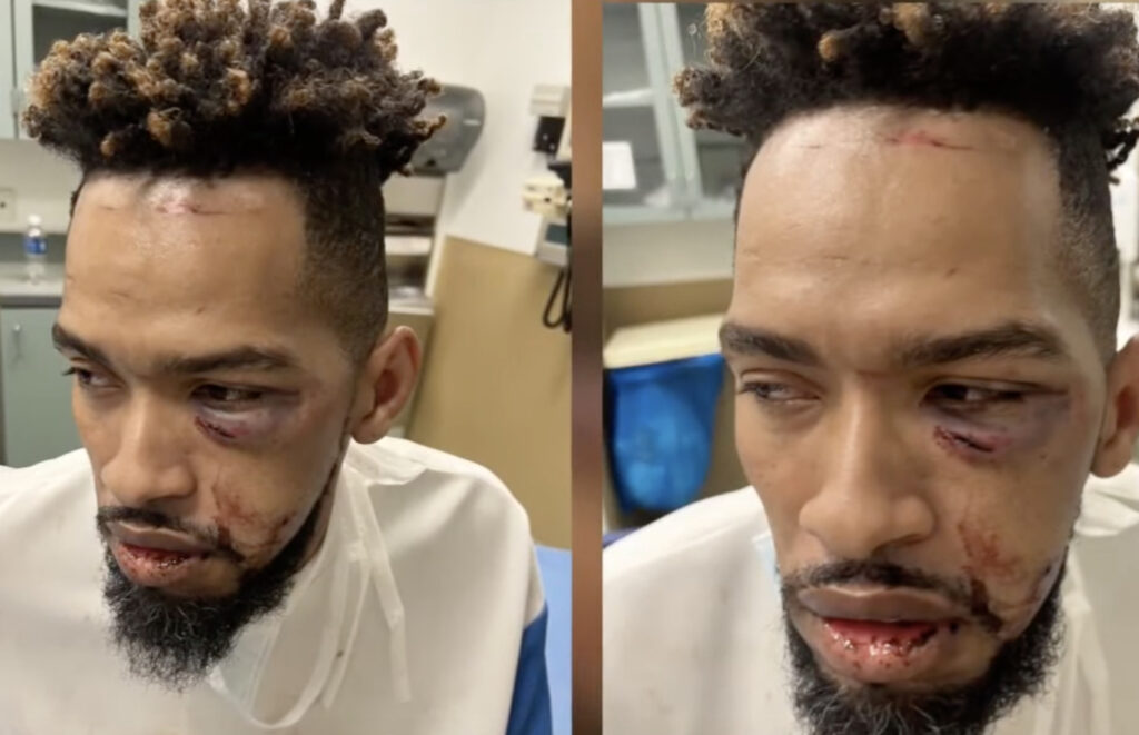 Gay Man Brutally Beaten By Straight Bouncers At Hamburger Mary’s In Texas