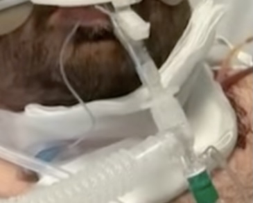 Woman Has Face Slashed And Man Has Neck Sliced Open By Kite String While Crossing NYC Bridge
