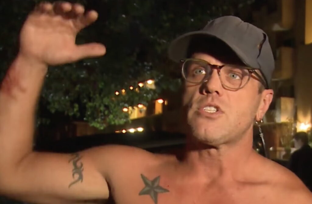 Hunky L.A. Man Describes Bloody Confrontation With Thief Who Stole Neighbors’ Mail