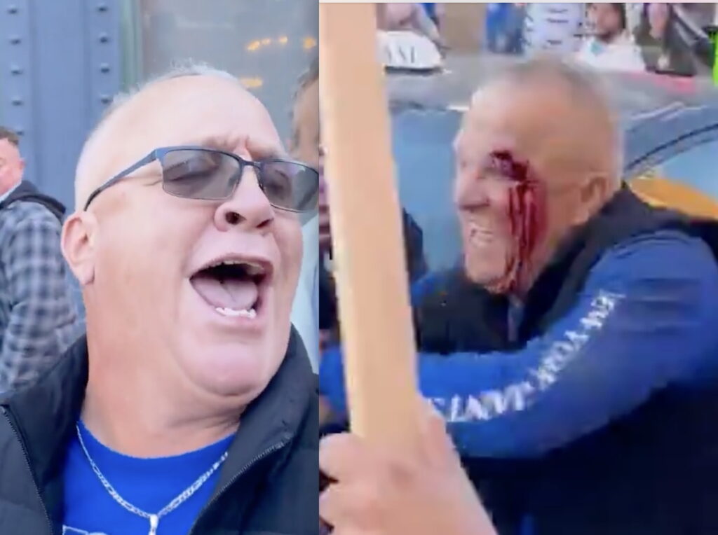 Pro-ICE Bigot Screaming “God Bless Trump” Eats Shit And Keeps Falling Down After Someone Steals His Glasses At No Kings Protest