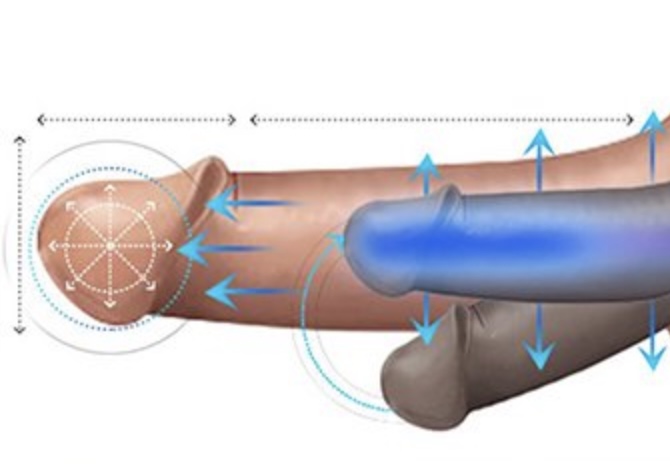 Louisiana Man Sentenced To Prison For Attempting To Buy Penis Enlargement Surgery With Stolen Credit Cards