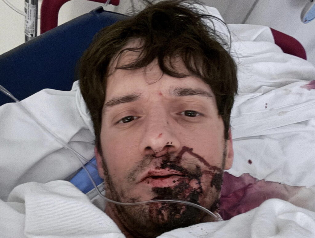 Gay Porn Star Ty Roderick Suffers Collapsed Lung After Being Stabbed Multiple Times