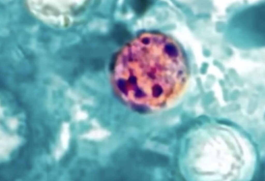 1,200+ Cases Of Explosive Diarrhea Linked To Contaminated Produce